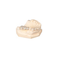 Pasadyang dental layered zirconia